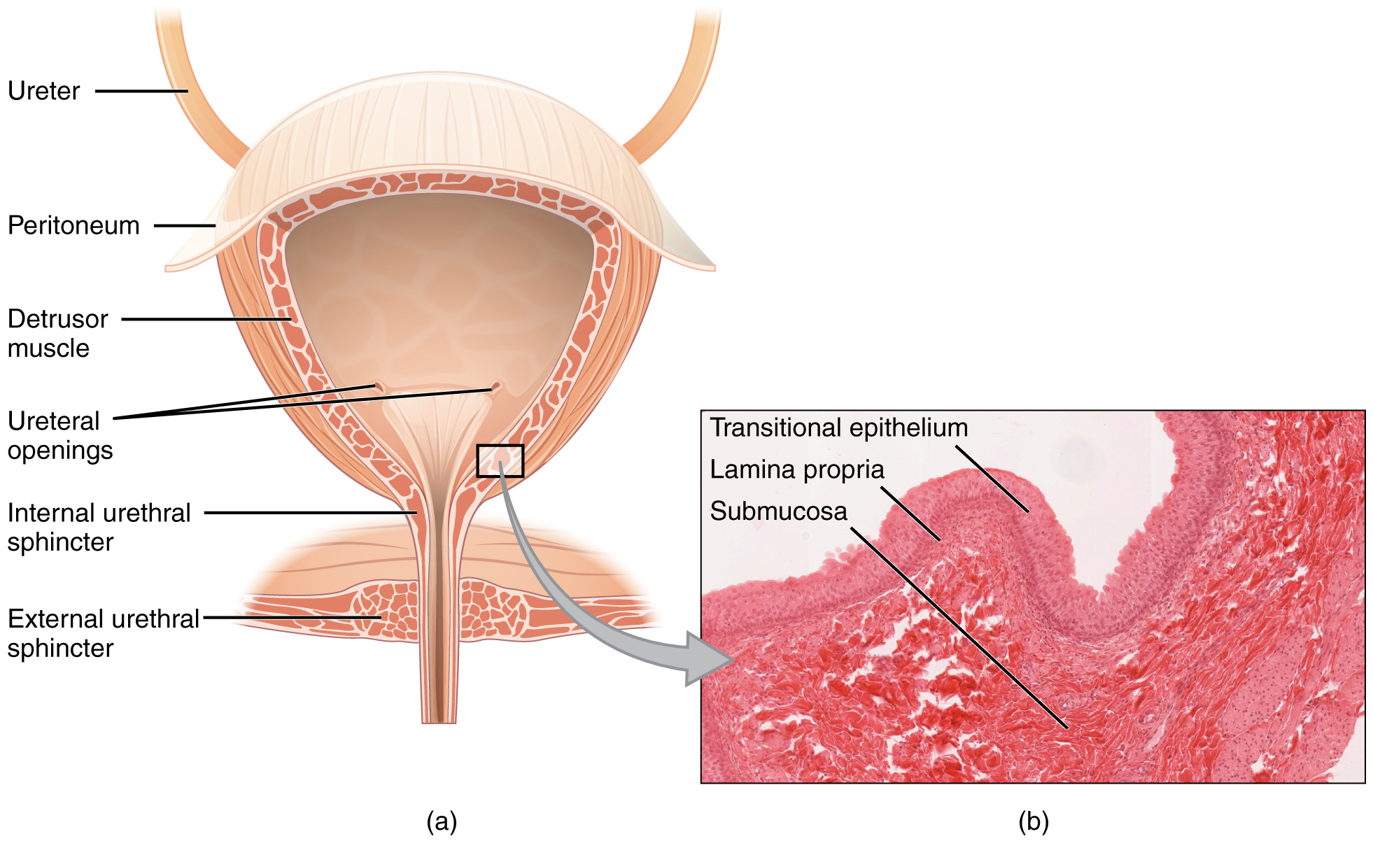 wandering bladder meaning