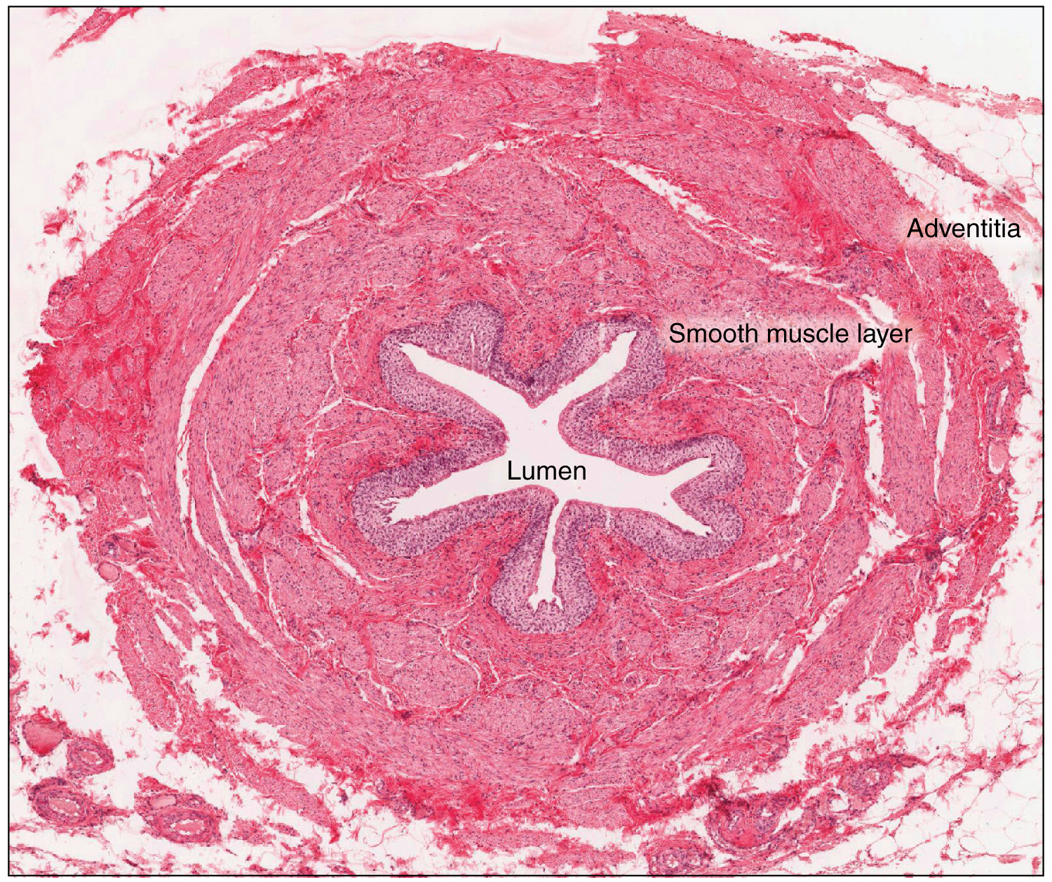Ureter Corte Histologico