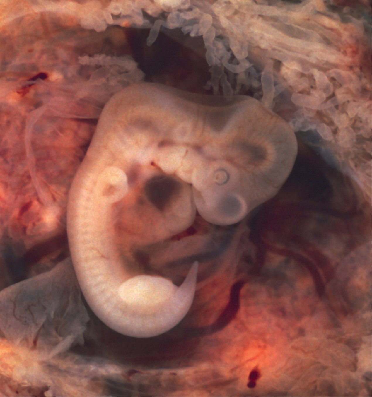 A photograph of an embryo derived from an ectopic pregnancy is shown.