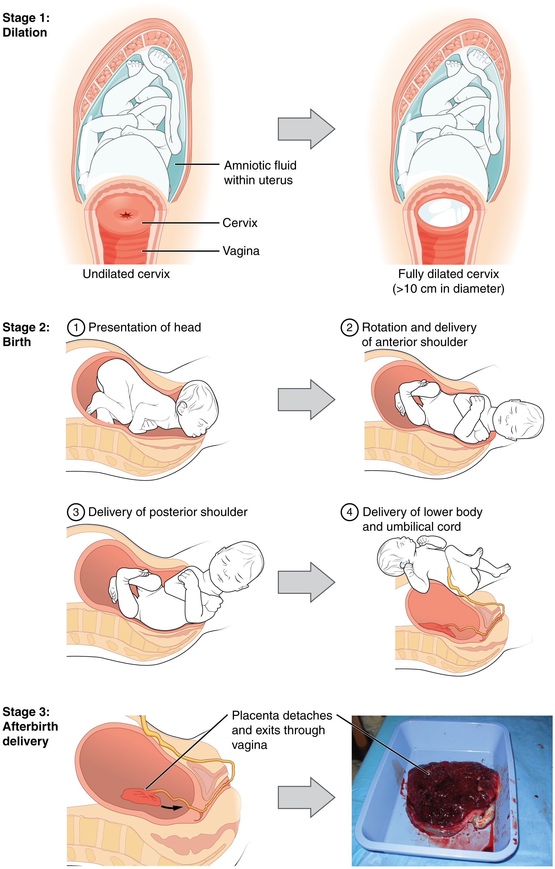 This multi-part figure shows the different stages of childbirth. The top panel shows dilation, the middle panel shows birth and the bottom panel shows afterbirth delivery.