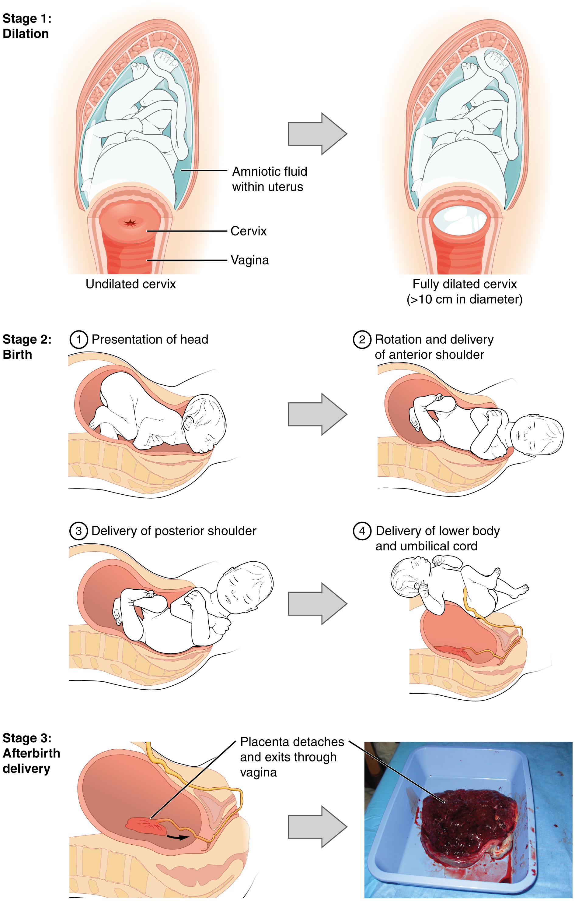 Pregnant Dilated 2 Cm 51