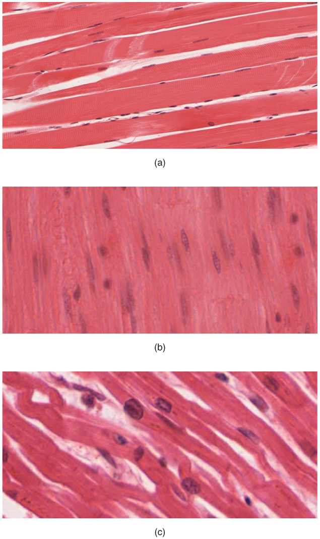 This figure show the micrographs of skeletal muscle, smooth muscle, and cardiac muscle cells.