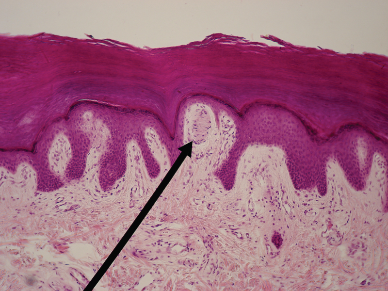 Functions of the Integumentary System · Anatomy and Physiology