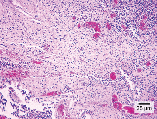 Part a: Salmonella viewed through a light microscope appear as tiny purple dots.