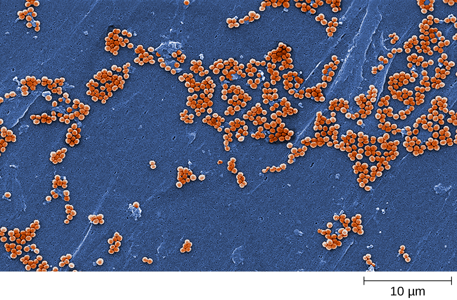 A micrograph  showing clusters of spherical cells.