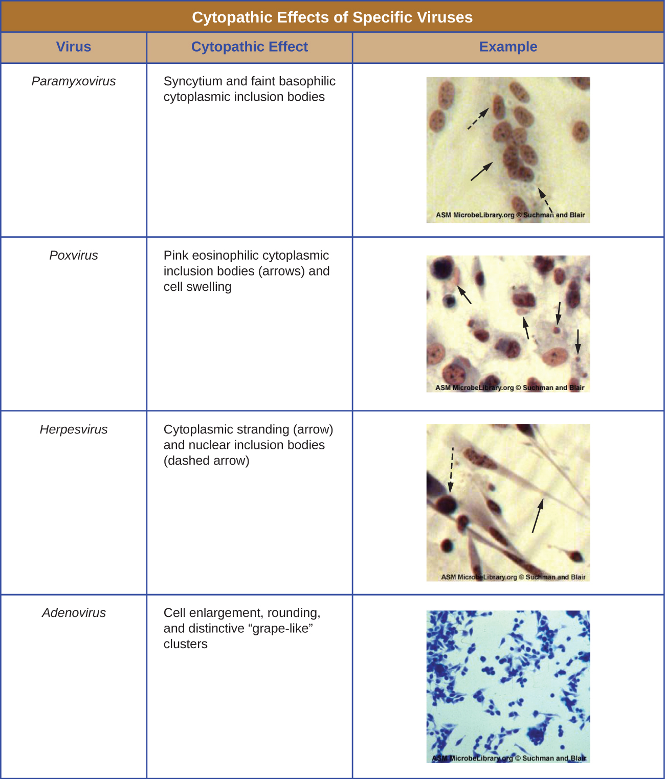 This is a table of cytopathic effects of specific viruses. The first example is paramyxovirus which causes syncytium and faint basophilic cytoplasmic inclusion bodies. Small structures are seen within a cell. Next, Poxyvirus results in pink eosinophilic cytoplasmic inclusion bodies (seen as small structures) and cell swelling. Next, Herpesvirus causes cytoplasmic stranding (seen as an eleongation of the cytoplasm) and nuclear inclusion bodies (seen as structures within the nucleus). Finally, Adenovirus causes cell enlargement, rounding, and distinctive grape-like clusters.