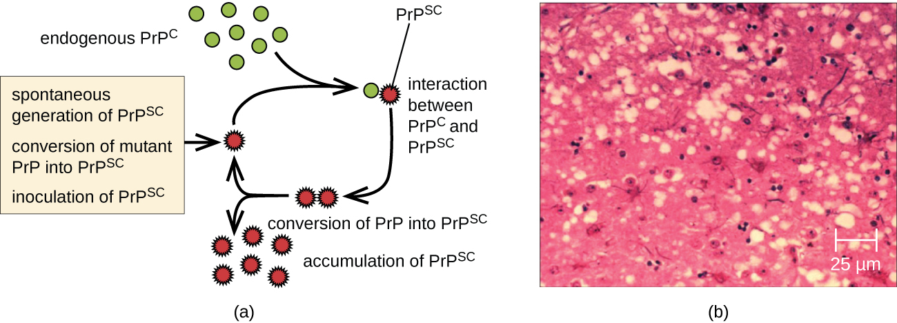 What Are Prions In Microbiology