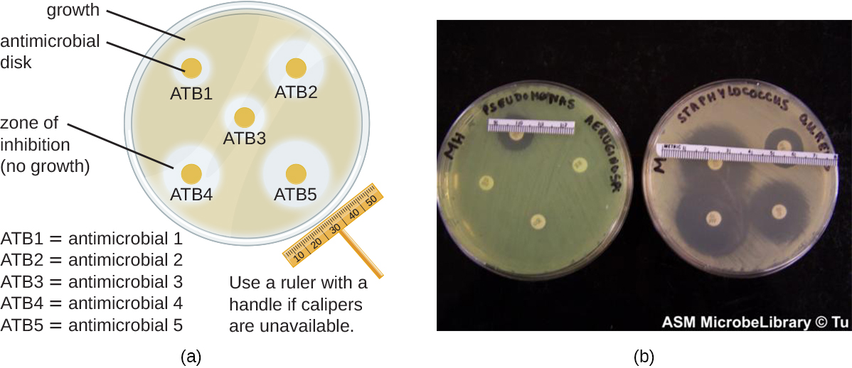 Antimicrobial activity. Метод диффузии в агар. Метод диффузии в агар цилиндрики. Streak Plate method. Microbiological Air Analysis картинки.