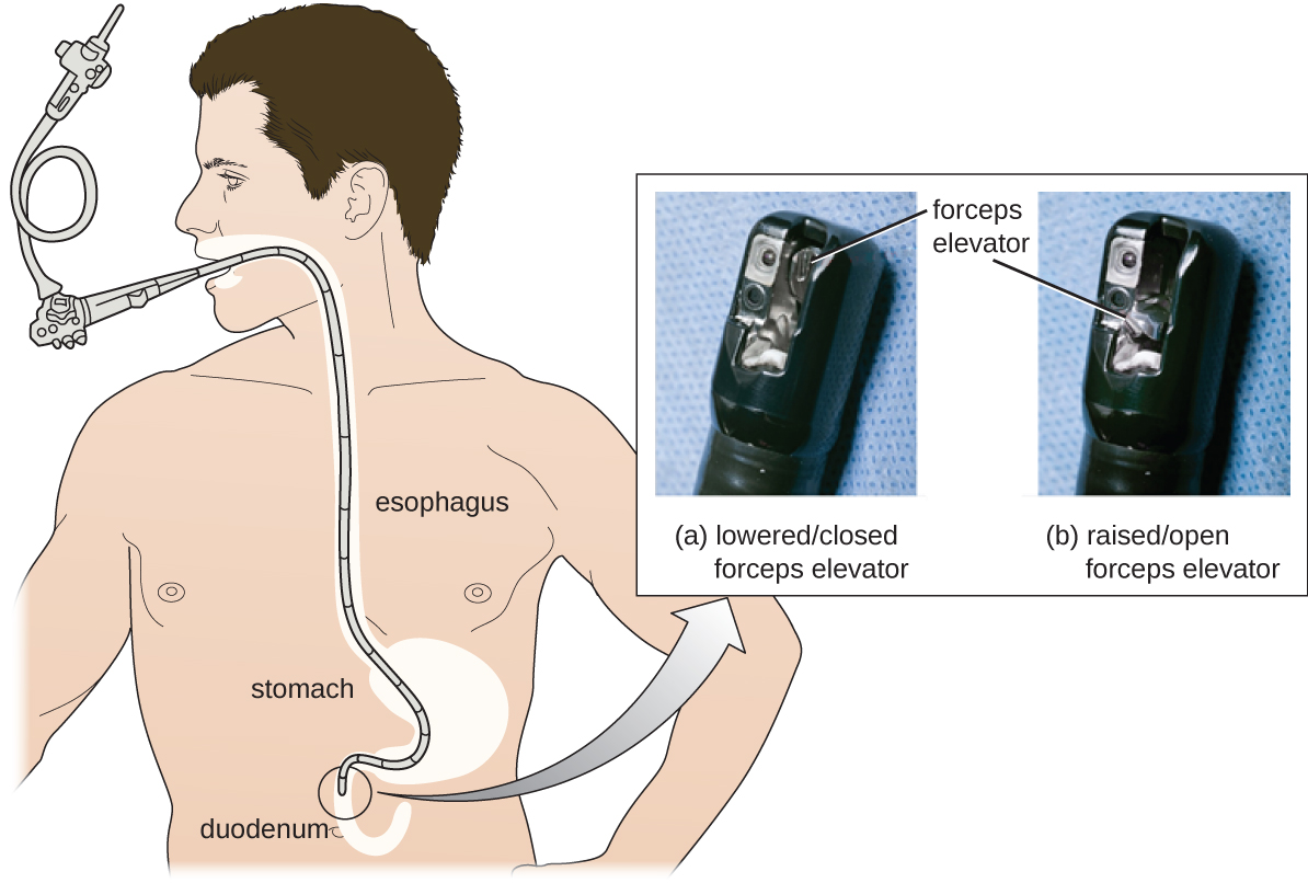 testing-the-effectiveness-of-antiseptics-and-disinfectants-microbiology