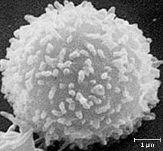 A micrograph of a round cell approximately 7 micrometer in diameter. The cell has a studded surface.