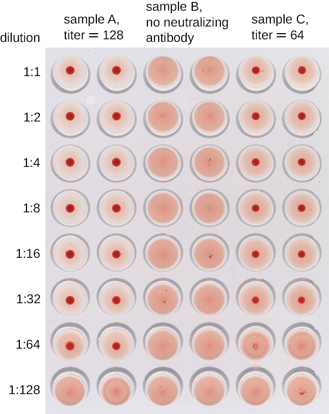 Agglutination Assays · Microbiology