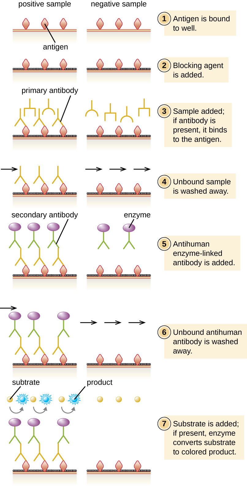 Diagram of indirect ELISA showing what happens in both a positive and a negative sample. First the antigens are bound to the well. This is shown as diamonds on a surface of both the positive and negative wells. Next, blocking agent is added. This is shown as a black covering on the surface between the antigens. Next, the sample is added. If the correct antibody is present it binds to the antigen. This is shown as Ys in both the positive and negative wells. Otherwise, nothing binds to the antigen. Next, any unbound sample is washed away. In the positive well, there is an antibody bound to the antigen, in the negative well, there is nothing bound to the antigen. Next, anti-human enzyme-linked antibody is added. This is shown as a Ys with a purple circle in both wells. Next, unbound antigen in washed away. In the positive sample this Y remains bound to the old antibody. In the negative well it is no longer present. Finally, substrate is added to both wells. In the positive well, the enzyme changes the substrate to a blue color.