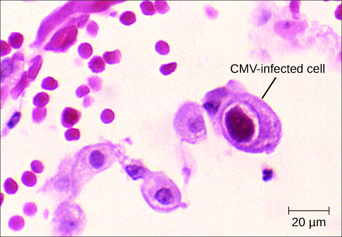 viral-infections-of-the-circulatory-and-lymphatic-systems-microbiology